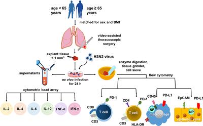 Impact of patient characteristics on innate immune responses and inflammasome activation in ex vivo human lung tissues infected with influenza A virus